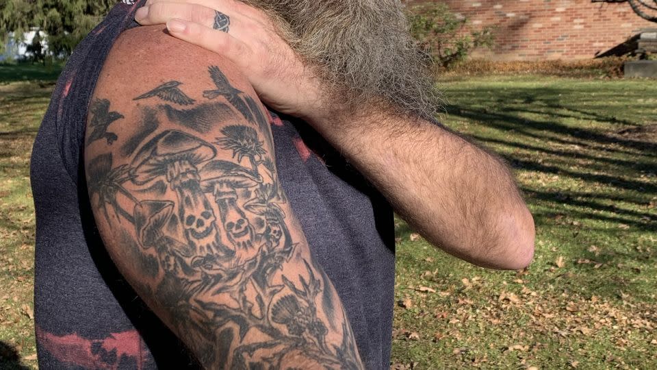 William D. Hickman's tattoo starts where doctors injected him with an antidote and ends of the mushrooms he ate and the milk thistle plant that saved him. - John Bonifield/CNN