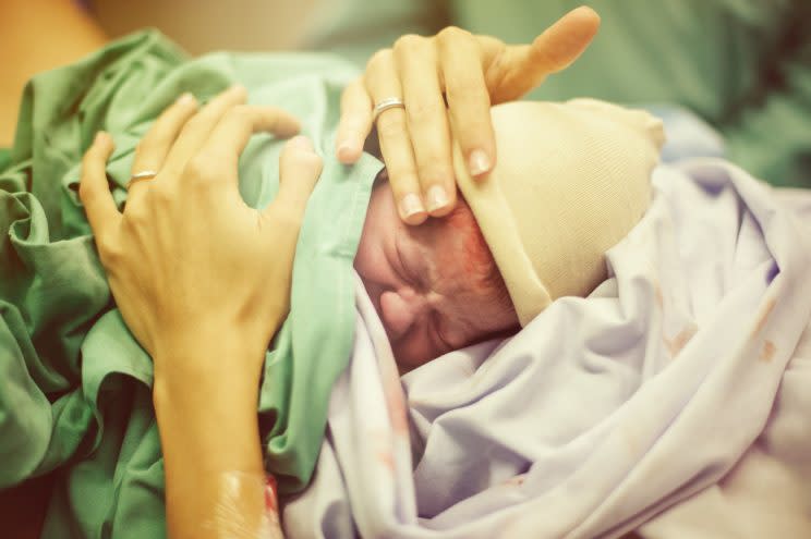 A new birth trend is seeing mums help delivery their own babies despite having a caesarean [Photo: Getty]