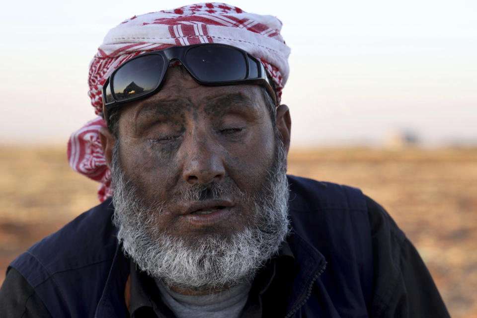 Ali Mansour, 43, who lost his eyes and hands to a cluster bomb in 2019, poses for a photograph at a camp in Idlib province, Syria, on July 19, 2023. More than 300 people were killed by cluster munitions in Ukraine in 2022, according to an international watchdog, displacing Syria as the country with the highest number of deaths from the controversial weapons for the first time in a decade. (AP Photo/Omar Albam)