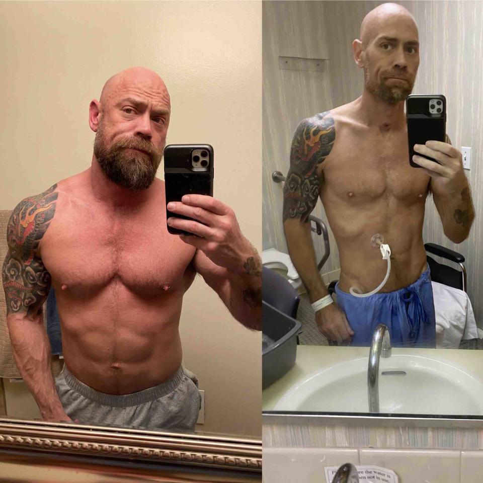Das linke Bild zeigt Mike Schultz einen Monat vor seiner Erkrankung, das rechte nach sechs Wochen Klinikaufenthalt (Bild: Instagram/thebearded_nurse)