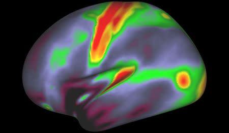 A map of myelin content (red, yellow are high myelin; indigo and blue are low myelin) in the left hemisphere of cerebral cortex is pictured in this undated handout image. Matthew F. Glasser, David C. Van Essen/Handout via REUTERS