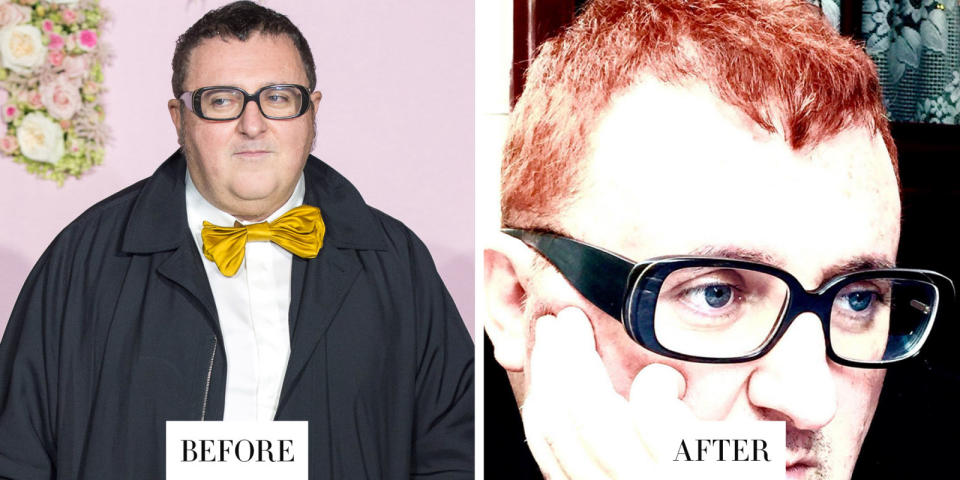 Alber Elbaz