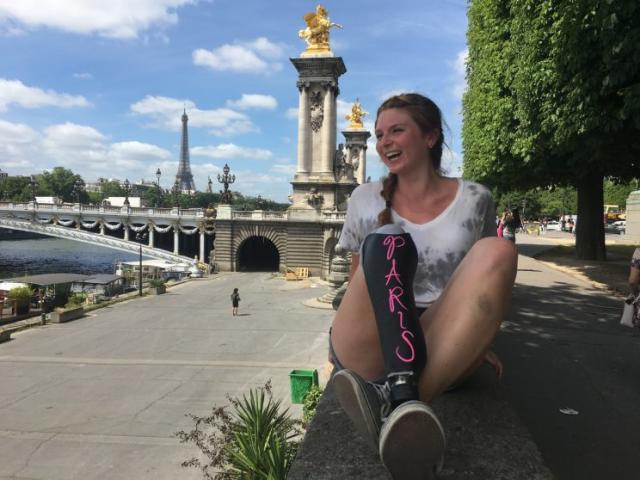 This Woman Turned Her Prosthetic Leg Into a Chalkboard to Document Her  Travels