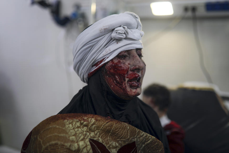 A wounded Palestinian woman receives medical treatment at the Nasser Hospital following an Israeli bombardment on Khan Younis refugee camp, southern Gaza Strip, Tuesday, Nov. 21, 2023. (AP Photo/Mohammed Dahman)