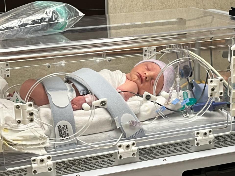 A newborn called Elliot lies in an incubator in the neonatal intensive care unit