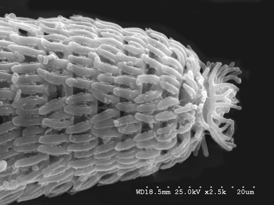 A scanning electron micrograph reveals a close-up of Crossonema menzeli — a parasitic nematode found on conifers.