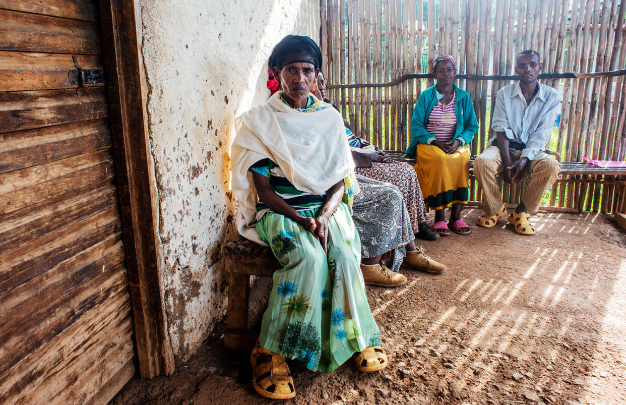 Wosani Wolanchu at a clinic in the village of Waro in southern Ethiopia. Wosani suffers from advanced stage podoconiosis. (Photo: Tom Gardner for HuffPost)