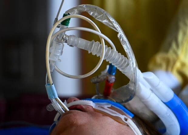 An intubated COVID-19 patient breathes with the assistance of a ventilator in the ICU at the Humber River Hospital in Toronto on Dec. 9, 2020. 