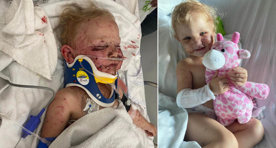 The toddler was knocked unconscious and viciously attacked by four puppies at her home. Source: Instagram/following_felicity