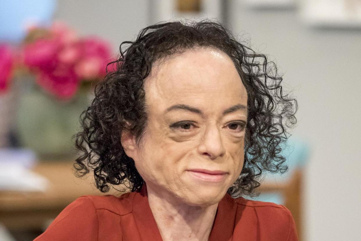Actress Liz Carr was attacked as she cross a road near Euston station: Rex Features