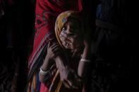 <p>Agar Yahia sostiene a su hija Awsaf, de 5 años, en Abyan (Yemen). La pequeña está extremadamente delgada debido a que solo ingiere la mitad de las calorías diarias indicadas para una niña de su edad. (Foto: Nariman El-Mofty / AP). </p>