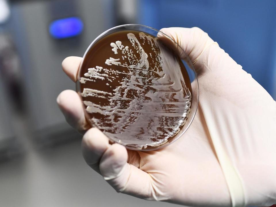 Twelve people have been killed by an outbreak of a rare bacterial infection in Essex, the NHS has said.Most of those affected were “elderly and had been receiving care for chronic wounds, in the community, either in their own homes and some in care homes”, according to the NHS Mid Essex Clinical Commissioning Group (CCG).The outbreak of invasive Group A streptococcus (iGAS) started in Braintree and spread to the Chelmsford and Maldon areas, it added. There have been 32 reported cases of the disease. An incident management team has been established to “control the incident and closely monitor the situation”.The bacteria can be found in the throat and on the skin and people may carry it without displaying any symptoms.It can live in throats and on hands for long enough to allow easy spread between people through sneezing, kissing and skin contact.The CCG said in a report that the “sometimes life-threatening GAS disease may occur when bacteria get into parts of the body where bacteria usually are not found, such as the blood, muscle, or the lungs”.Rachel Hearn, director of nursing and quality, Mid Essex CCG, said: “Our thoughts are with the families of those patients who have died. The NHS in Essex is working closely with Public Health England and other partners to manage this local incident, and extra infection control measures have been put in place to prevent the infection spreading in the area.“The risk of contracting iGAS is very low for the vast majority of people and treatment with antibiotics is very effective if started early. We will continue to work with our partners in Public Health England to investigate how this outbreak occurred and take every possible step to ensure our local community is protected.”