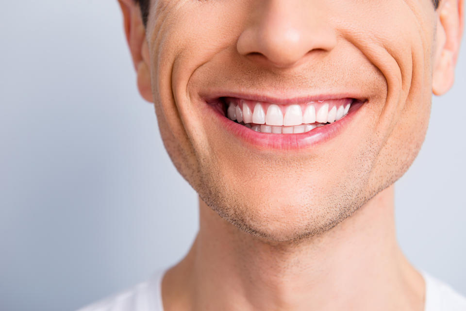 It's time to get back in your dentist's good graces. (Photo: Getty Images)