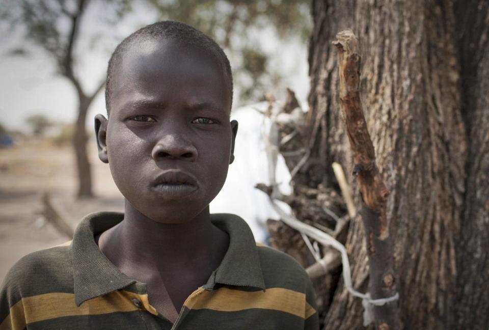 In this photo taken Saturday, Feb. 15, 2014, Ajing Abiik, 12, who fled from his hometown of Bor when the fighting broke out in December, stands next to the tree where he and his two brothers sleep in Minkaman IDP camp, Awerial County, in South Sudan. The fighting in the world’s newest country has left thousands of its youngest citizens either orphans or separated from their parents, increasing their vulnerability to sickness, malnutrition and recruitment by warring groups as child soldiers. (AP Photo/Mackenzie Knowles-Coursin)