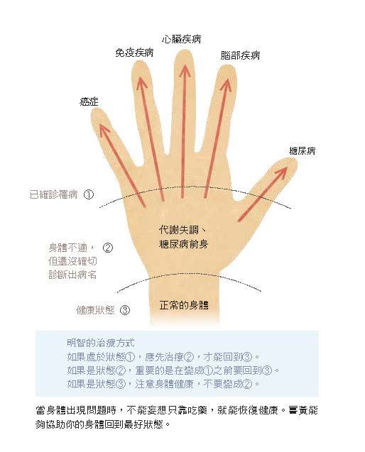 把手掌想成代謝失調，不論是癌症還是糖尿病，最終都始於代謝失調。（圖／大是文化提供）