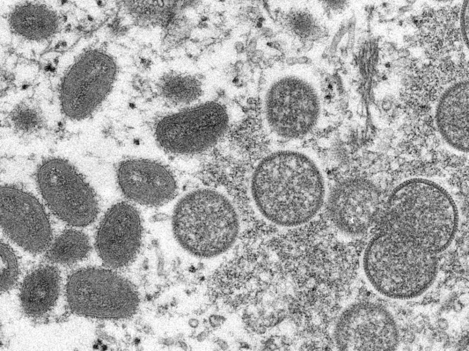An electron microscopic image shows mature, oval-shaped monkeypox virus particles (Reuters)
