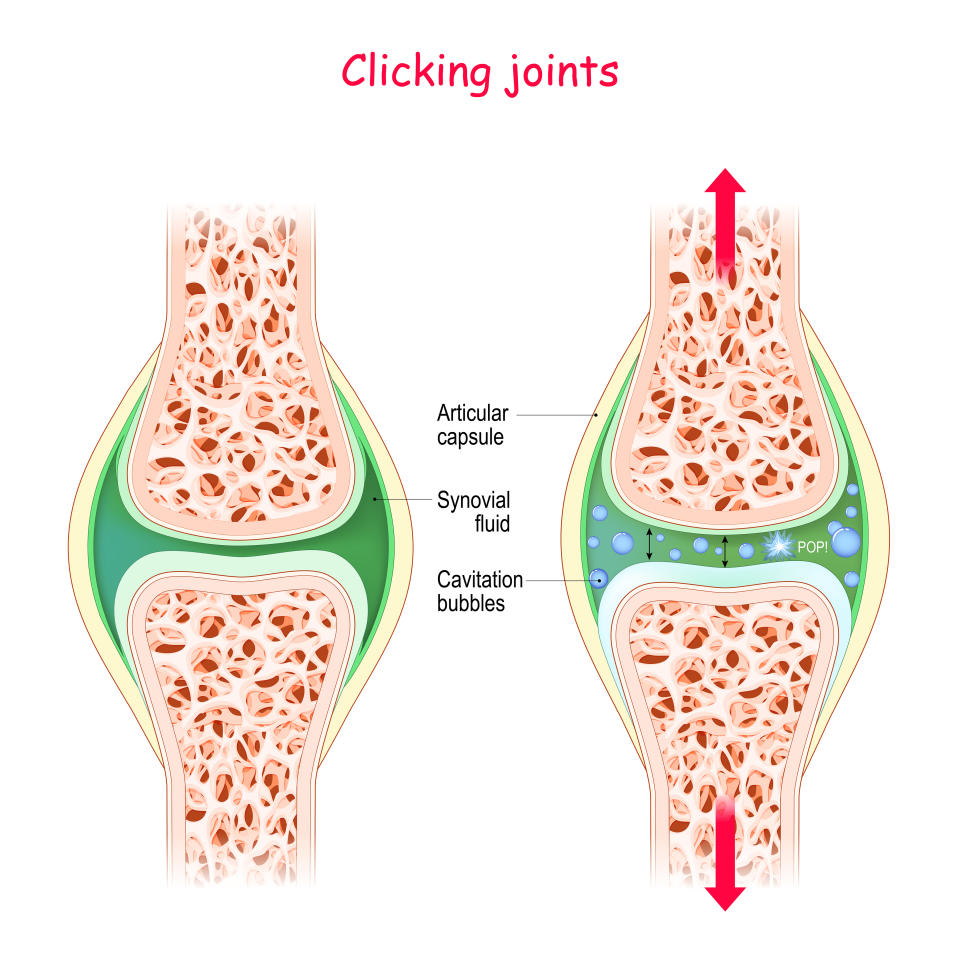 Joints and popping sound diagram - Physiological Mechanism of cavitation. 