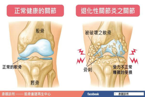 到底是不是任何時候都需要吃它們呢？到底他們有沒有這麼有效