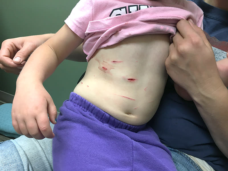 4-Year-Old Girl Survives Mountain Lion Attack During Camping Trip: 'He Had My Daughter in His Mouth,' Says Dad| Exotic Animals & Pets, Personal Tragedy, Real People Stories