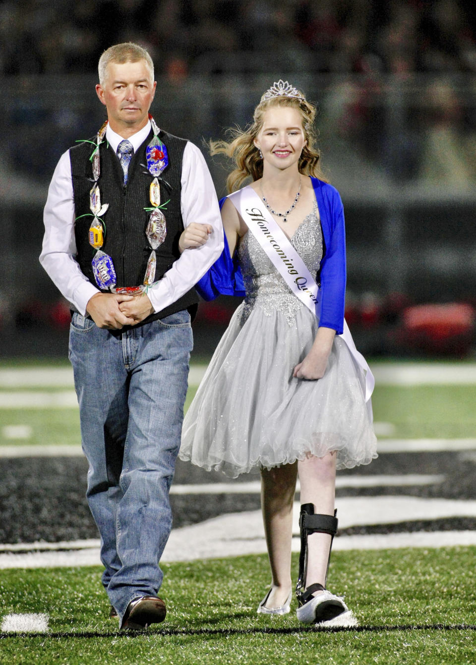 In this Friday, Sept. 27, 2019, photo, Deserae Turner walks with her father Matt Turner at the Homecoming Court ceremony during halftime of Green Canyon's football game in North Logan, Utah. Turner, a Utah high school student who survived a gunshot wound to the head was named homecoming queen by her classmates. Turner was found in a ditch after being shot in the back of the head and left for dead by two classmates in February 2017. (John Zsiray/5150photos.com via AP)