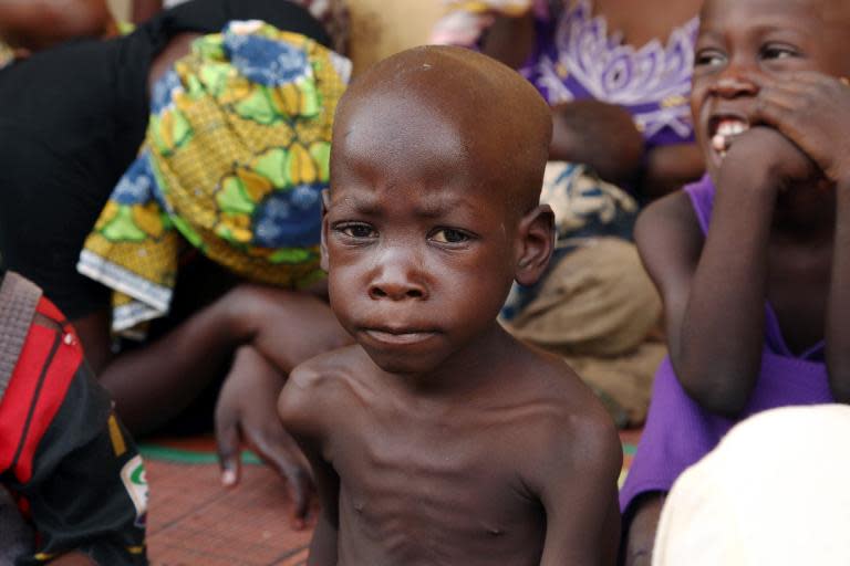 A malnourished child at the Malkohi refugee camp in the eatern Nigerian city of Yola, on May 5, 2015