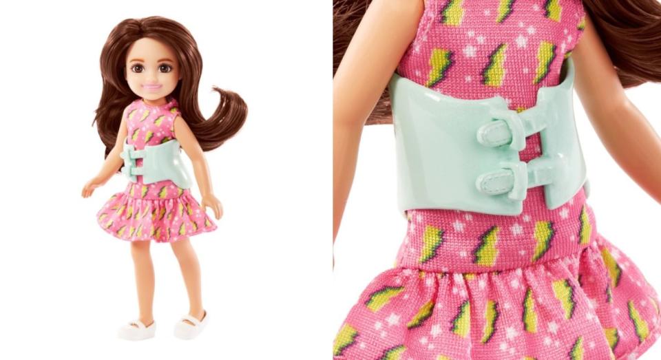 Mattel have introduced a new Barbie doll with scoliosis. (Mattel/PA Images)