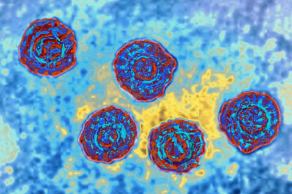 <span class="caption">The hepatitis C virus was discovered in 1989 – research that's now earned a Nobel Prize.</span> <span class="attribution"><a class="link " href="https://www.gettyimages.com/detail/news-photo/hepatitis-c-virus-hcv-causes-blood-borne-hepatitis-news-photo/1158016725" rel="nofollow noopener" target="_blank" data-ylk="slk:BSIP/Universal Images Group via Getty Images;elm:context_link;itc:0;sec:content-canvas">BSIP/Universal Images Group via Getty Images</a></span>