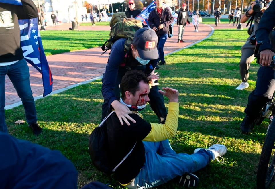 An injured supporter of US President Donald Trump is helped after being assaulted by an unknown assailant in Washington, DC.