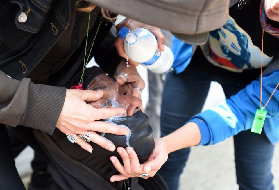 A woman has milk poured in her eyes after she was sprayed with a chemical irritant as fights broke out between Trump supporters and anti-Trump protesters in Berkeley, California, on April 15, 2017.