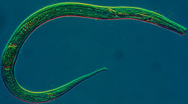 Expert David Morgan said the parasites are probably roundworms or nematodes (pictured). Source: AAP / Stock image