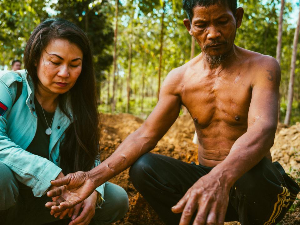 Unexploded ordnance from U.S. bombing is a multigenerational problem. Yong Kham, 64, shows his scars and the shrapnel still embedded in his forearms – from an accident 40 years ago – to Khamsone Sirimanivong on Nov. 10, 2022, in southern Laos. They're sitting in a crater where in 2003, a bomb killed Kham's 20-year-old son.