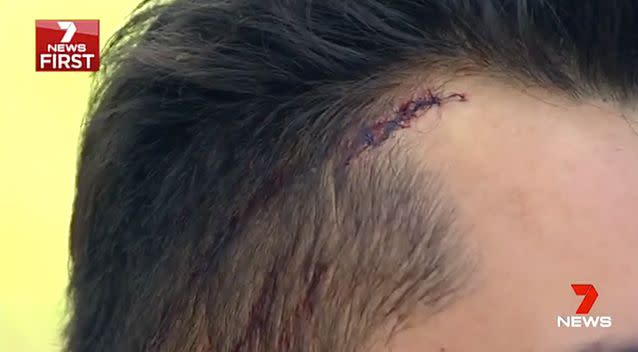 A man in the truck required seven stitches to his head after the crash. Photo: 7 News