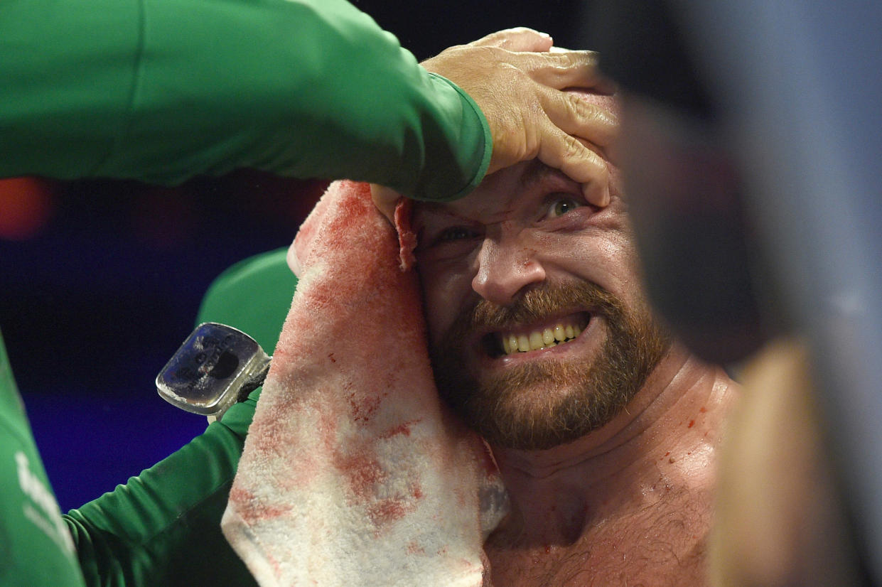 LAS VEGAS, NEVADA - SEPTEMBER 14: Tyson Fury is tended to in his corner between rounds during his heavyweight bout against Otto Wallin at T-Mobile Arena on September 14, 2019 in Las Vegas, Nevada. Tyson won by an unanimous decision after the 12-round bout.  (Photo by David Becker/Getty Images)