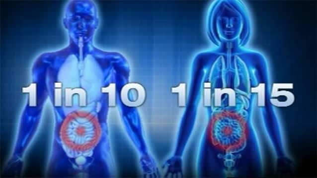 The risk of being diagnosed with bowel cancer is one in 10 for men, and one in 15 for women. Photo: 7News