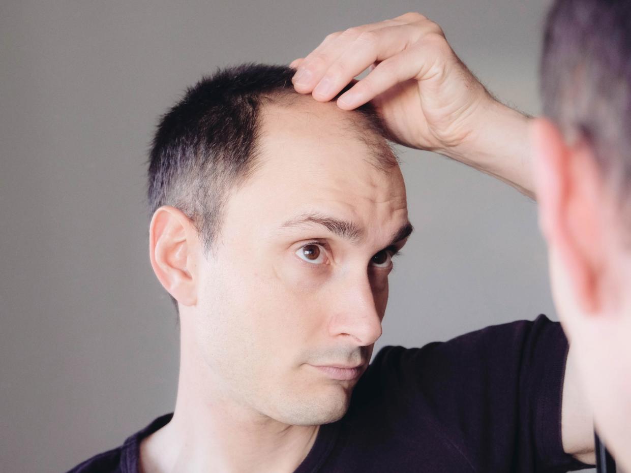 Man looking at his hair line