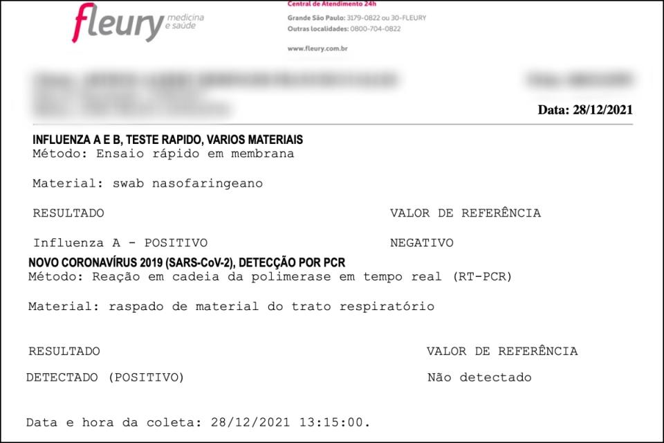 Exames feitos no Laborat&#xf3;rio Fleury comprovaram a infec&#xe7;&#xe3;o simult&#xe2;nea de Influenza A e Covid-19 no paciente de 4 anos. (Foto: Yahoo Not&#xed;cias)