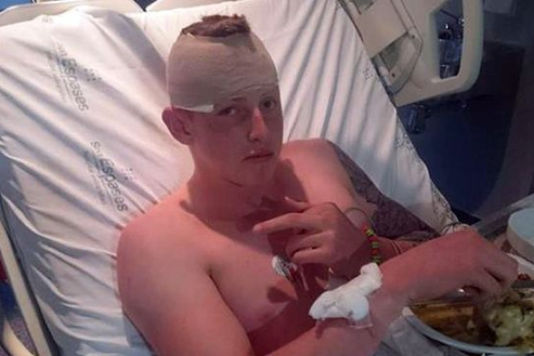 Scottish teen in hospital after sleepwalking off Magaluf hotel balcony