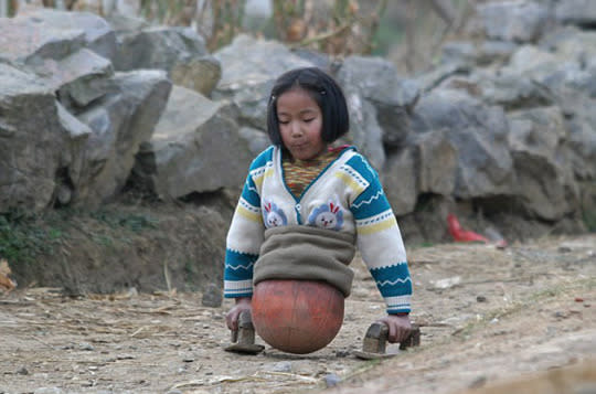 How a “basketball girl” who lost both legs in a traffic accident became an inspiring swimming champion