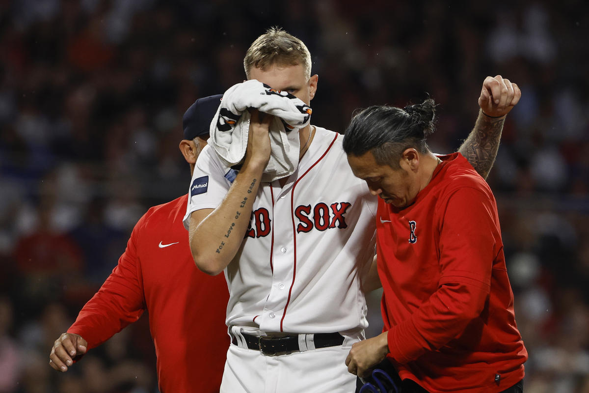 #Red Sox’s Tanner Houck suffers facial fracture, out indefinitely after line drive to face [Video]