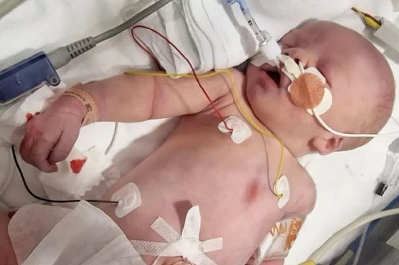 Baby Theo in hospital where he died after complications during his birth