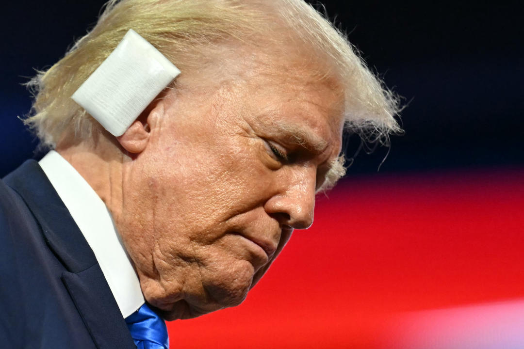 Trump at the Republican National Convention, with a bandage on his right ear after the assassination attempt.     he 2024 Republican National Convention at the Fiserv Forum in Milwaukee, Wisconsin, July 16, 2024. Days after he survived an assassination attempt Donald Trump won formal nomination as the Republican presidential candidate and picked right-wing loyalist J.D. Vance for running mate, kicking off a triumphalist party convention in the wake of last weekend's failed assassination attempt. (Photo by ANGELA WEISS / AFP) (Photo by ANGELA WEISS/AFP via Getty Images)