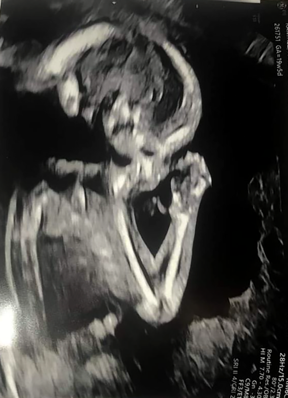 Justin Johnson often refers to this ultrasound image of his daughter, Amillianna Ramirez-Johnson, taken at Columbia St. Mary's Hospital on April 26, 2021, as a forewarning she was asking for help. “She was praying. She knew something was going to happen,” Johnson said.