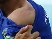 Italy's Giorgio Chiellini shows his shoulder June 24, 2014. REUTERS/Tony Gentile