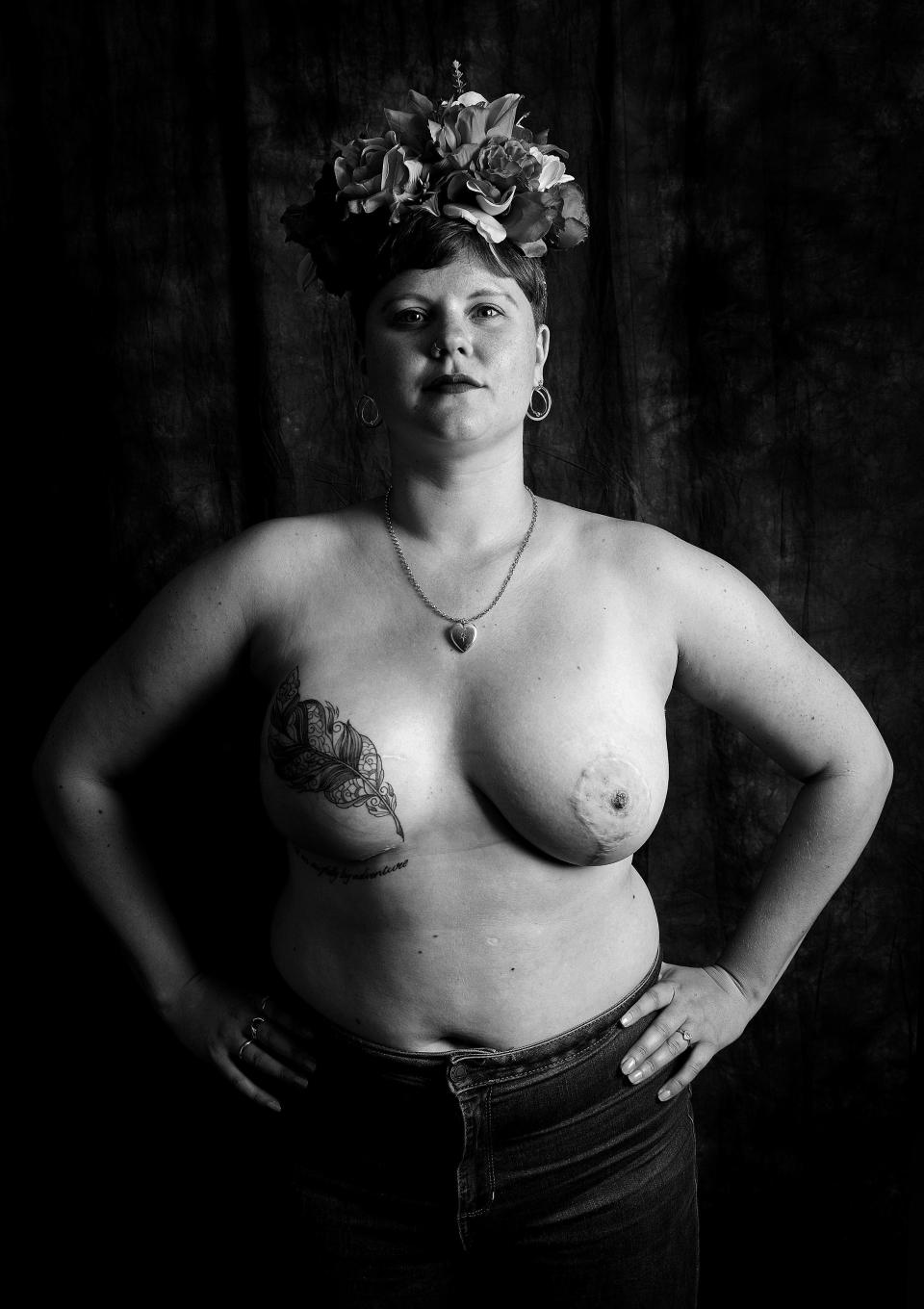 One of sixteen men and women who have bared their scars as part of a project called 'Defiance'.