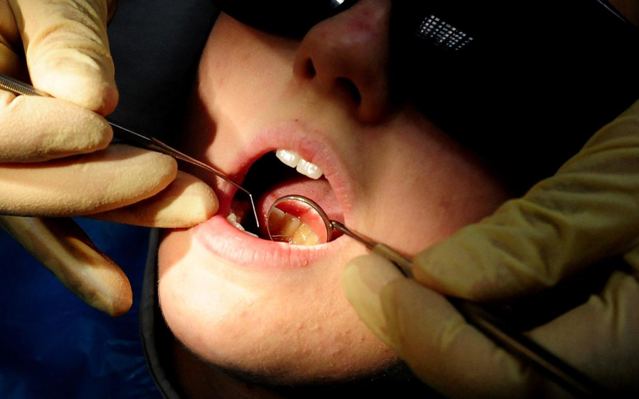 The discovery could help tackle tooth decay - PA
