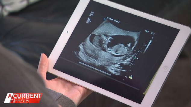 MAFS' Bryce and Melissa's baby scan
