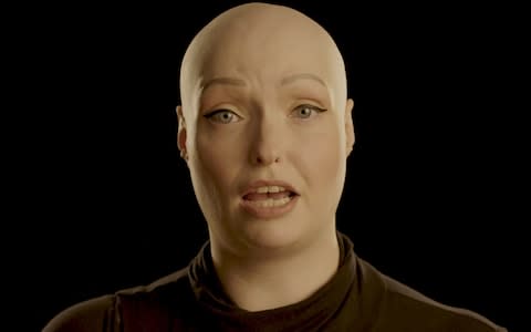 Brenda Finn, who has alopecia - Credit: Changing Faces/Changing Faces