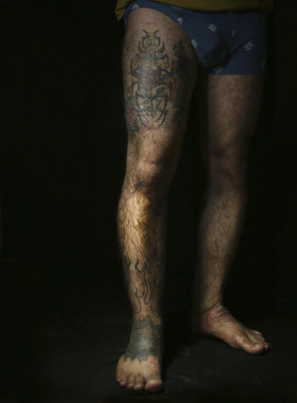 In this Wednesday. Oct. 24, 2018, photo, Iraqi soldier Saad Khudeir displays tattoos on his leg to cover scars of the burns he suffered in a car bombing, in Baghdad, Iraq. “People stared at me and sometime I felt they were scared of me at the swimming pool,” Khudeir, 36, told The Associated Press, recalling how he decided to cover up his scars to for a better appearance. (AP Photo/Hadi Mizban)