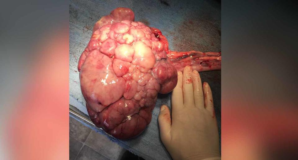 A 2.7 kilogram ovarian tumour was removed from the dog’s abdomen. Source: Monto Veterinary Surgery/ Facebook