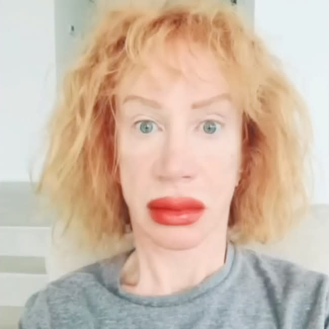 Kathy Griffin stuns fans by showing off massively swollen lips after